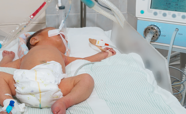 Ventilación mecánica en pediatría