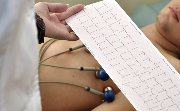 Electrocardiografía